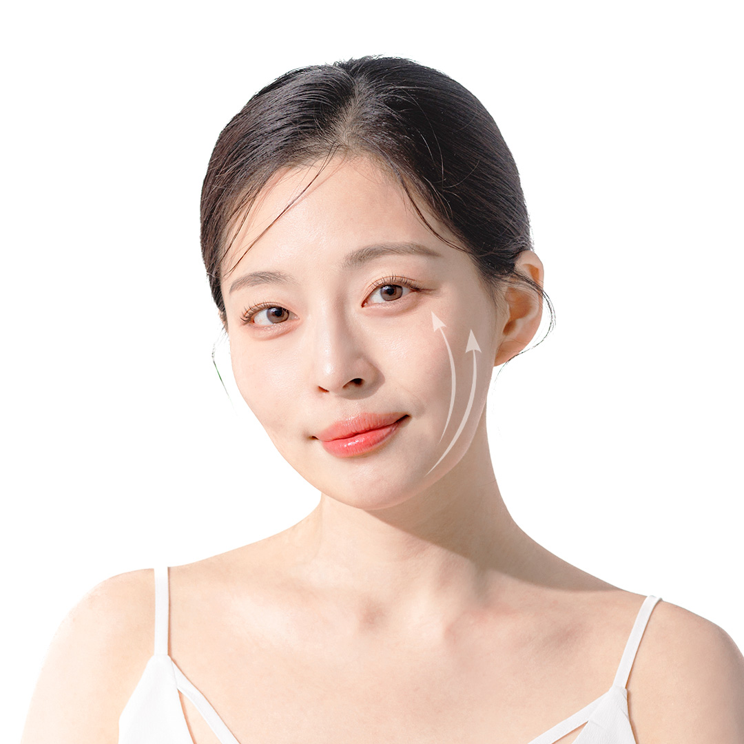 여우실리프팅