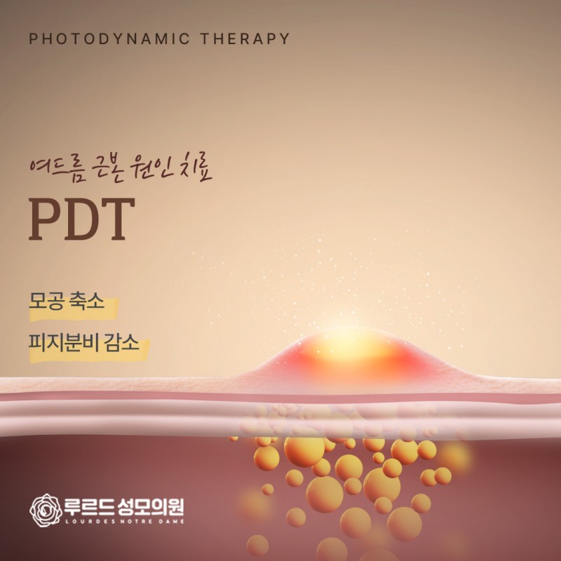 PDT